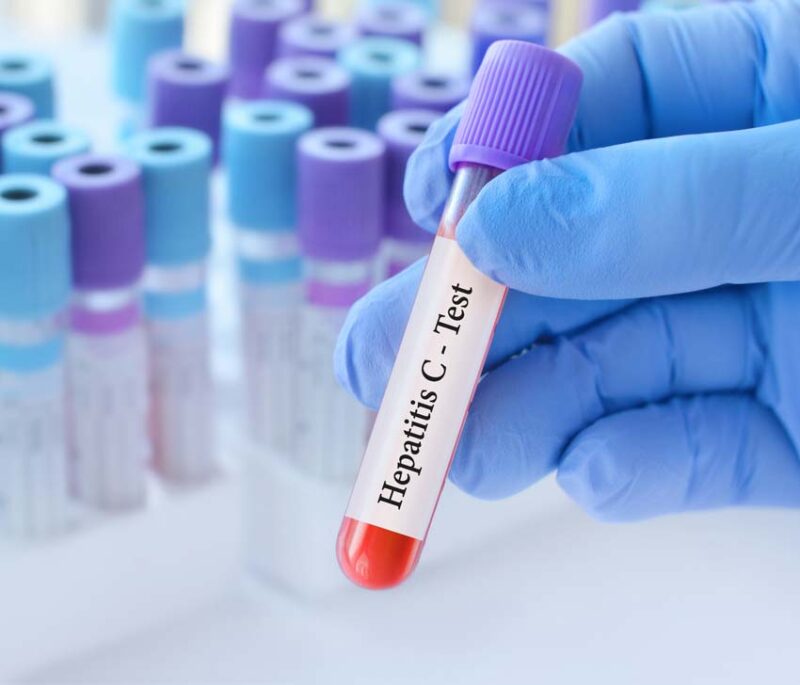 Potential causes of hepatitis hepatisitjun24 800x685 1