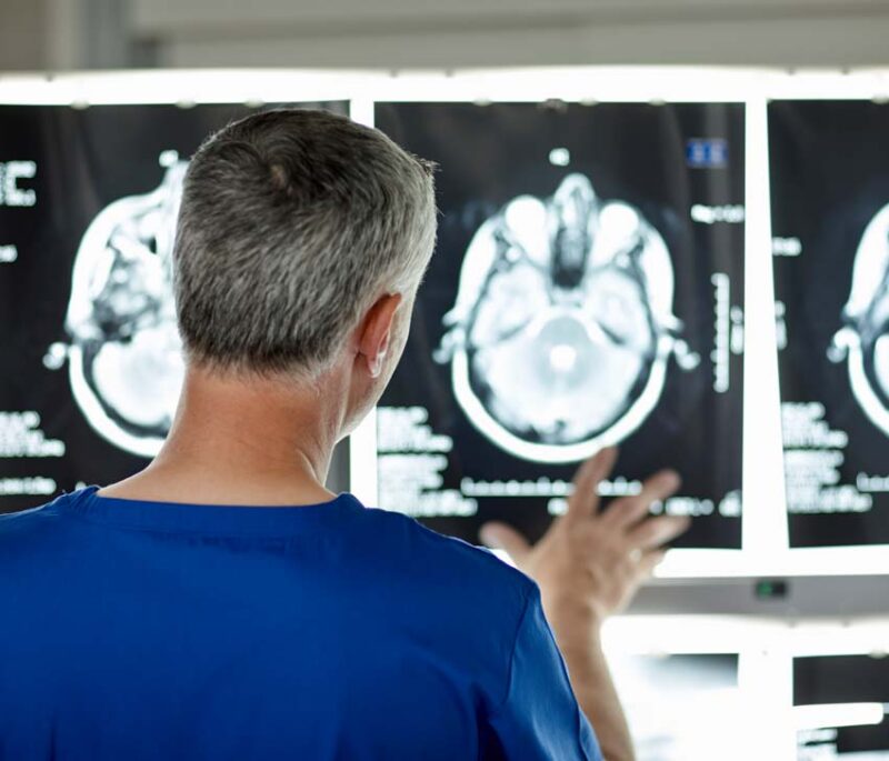 Am I Having a Stroke? What Should I do? strokeoct24 800x685 1